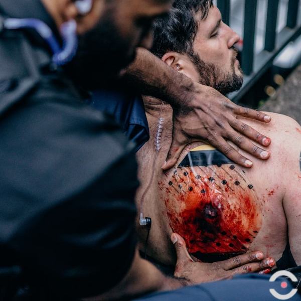 Opatrunek okluzyjny Sam Chest Seal do uszczelniania ran klatki piersiowej (2 szt.)